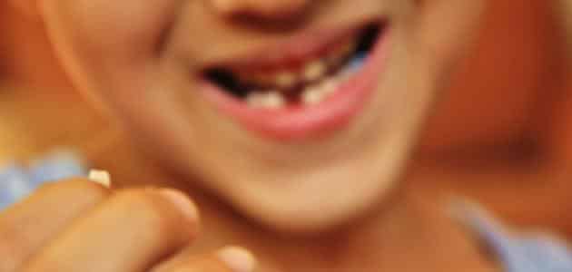 تفسير حلم نزع تقويم الاسنان في المنام لابن سيرين